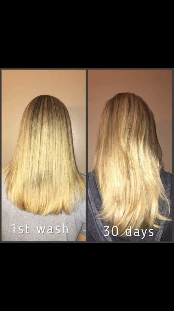 What worked for your hair regrowth? Quora