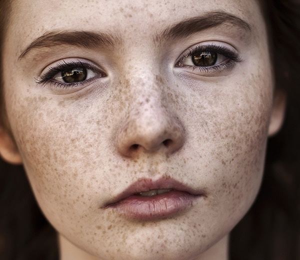 What do guys think of girls with freckles? Quora