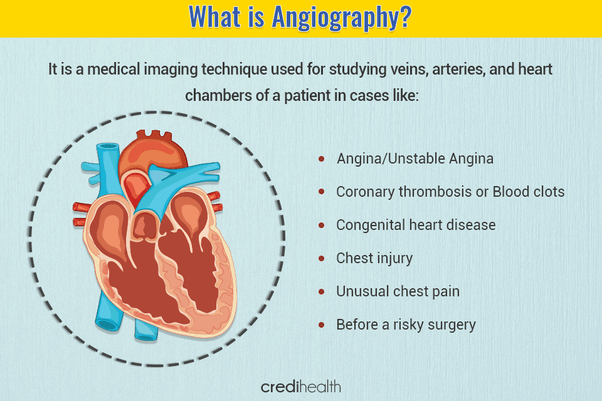 What is angiography? Quora