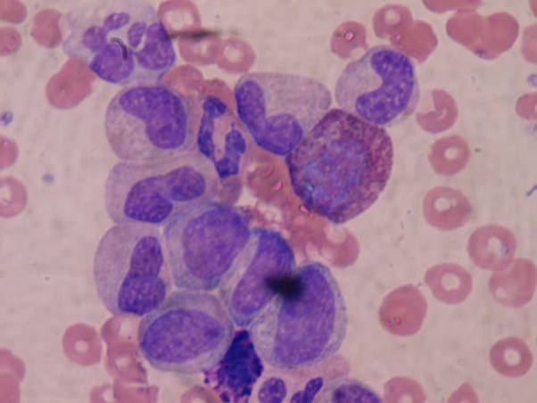What is the normal range of RBC & WBC and haemoglobin? Quora