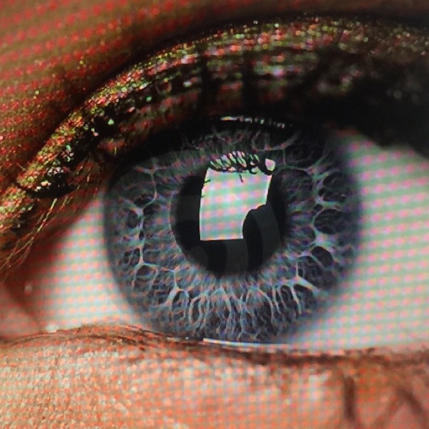 Do I have central heterochromia or not? Quora