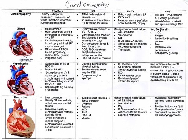 What is the difference between dilated cardiomyopathy and HCM? Quora