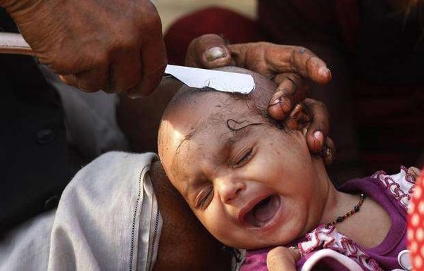 What is your opinion on shaving a baby's head to get rid