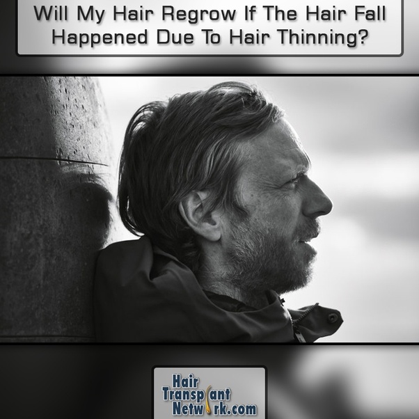 How to really regrow hair that is thinning Quora