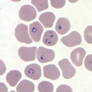 Where Can I Find Malarial Parasite Images Quora