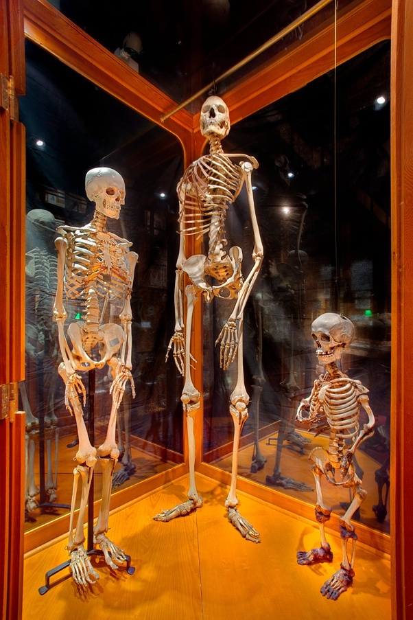 Why is the phrase 'bigboned' tolerated? Have you ever seen a bigboned