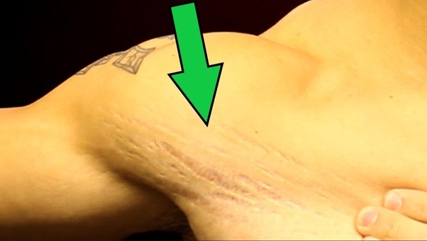 How did Celebrities like Arjun Kapoor and Bhumi Pednekar lose weight