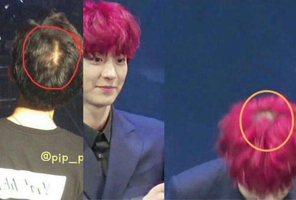 How can Kpop idols dye their hair so much without it