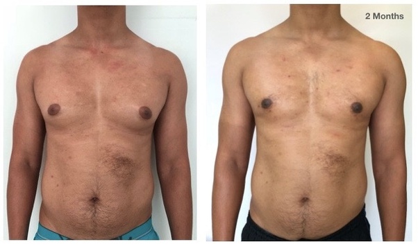 Where can I get surgery done in Bangalore? Quora