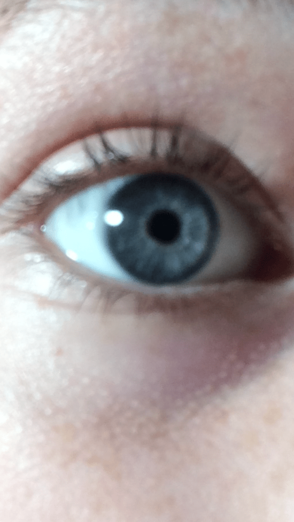 What do your eyes look like? Quora