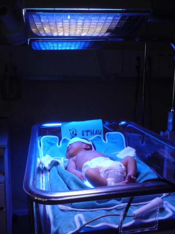 How does exposure to ultraviolet light cure jaundice in neonates (newborn children)? Quora