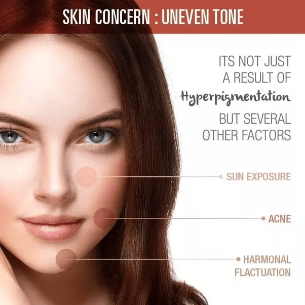 Why do I have an uneven skin tone? Quora