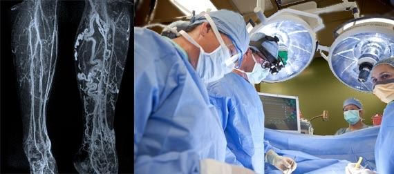 What is the purpose of Interventional radiology? Quora