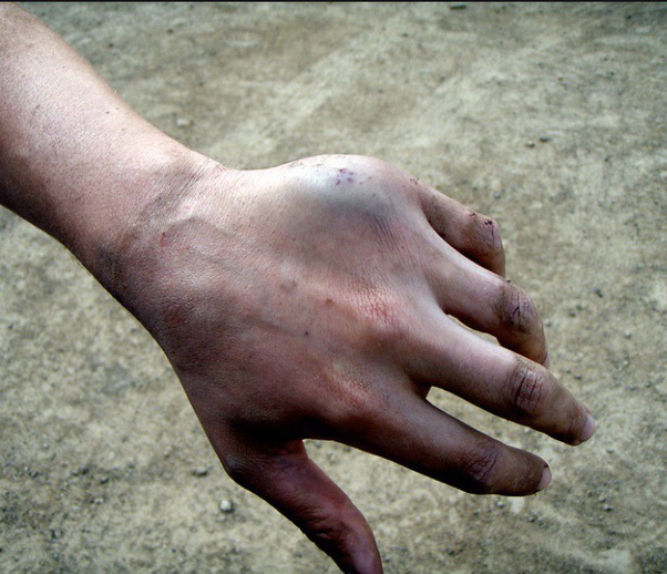 How should I form my fist when punching someone in a real fight? Quora