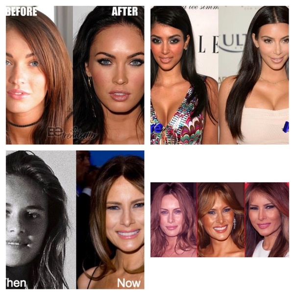 Can I change my round eyes to almondshaped eyes, without makeup? Quora
