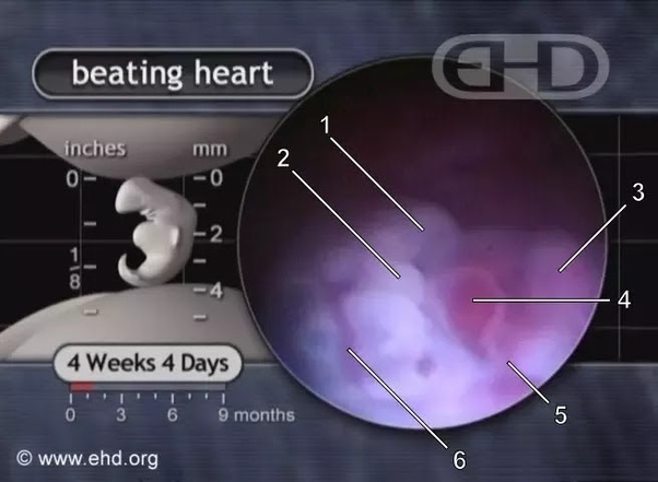 How to abort two weeks pregnancy without using pills or surgery Quora