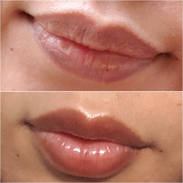 Bagaimana cara mencerahkan bibir yang gelap? Quora