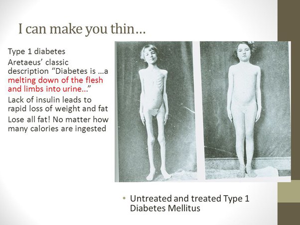 Why Do Diabetics Lose Weight, If And When They Do? - Quora