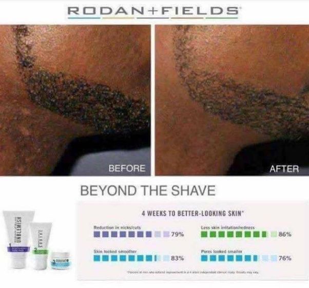 What can I do to prevent itchy razor bumps after shaving