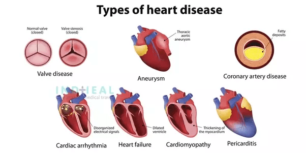 What are the top hospitals in India for cardiology? Quora