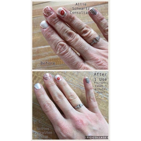 My hands so dry that they burn and turn really red. If I use