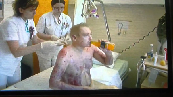 Can a human survive 200 degrees Fahrenheit? Quora