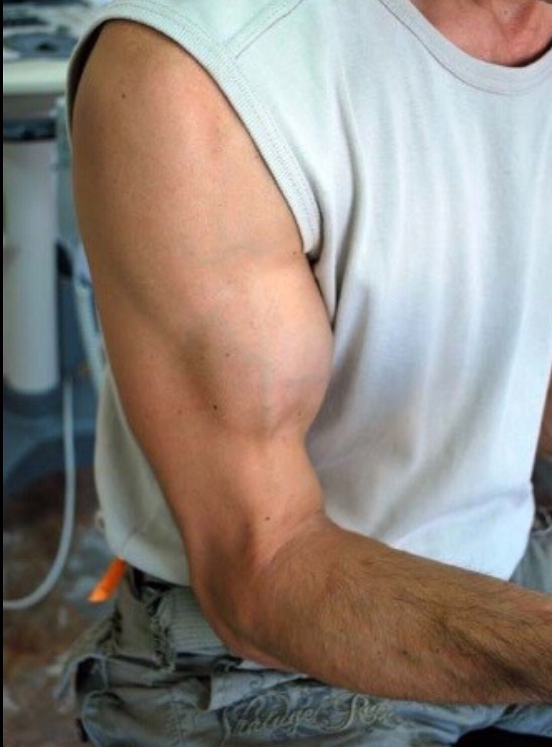 Bagaimana cara mengetahui apakah otot bisep Anda robek - Quora