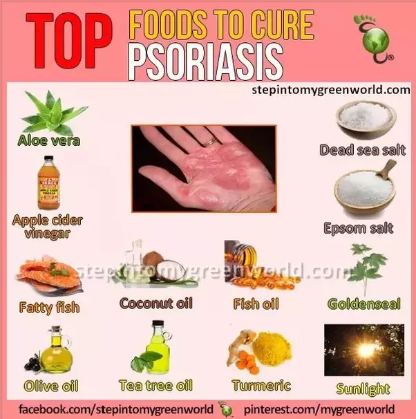 Is there a permanent cure for psoriasis? Quora