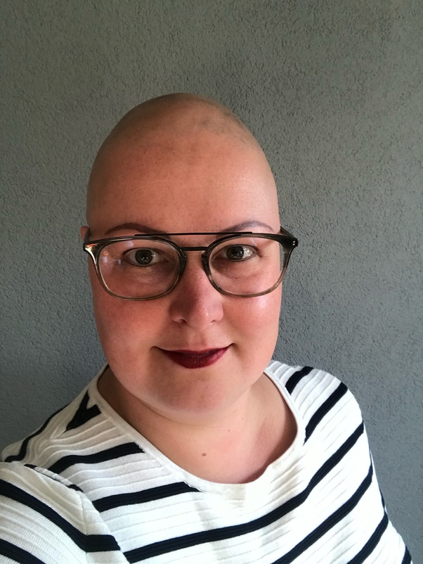 If you have alopecia can you cut your hair bald? Quora