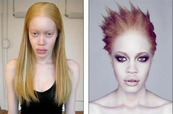 White or gray hair due to aging (old age) cannot turn black again naturally. Can a black person have blonde hair and blue eyes and ...