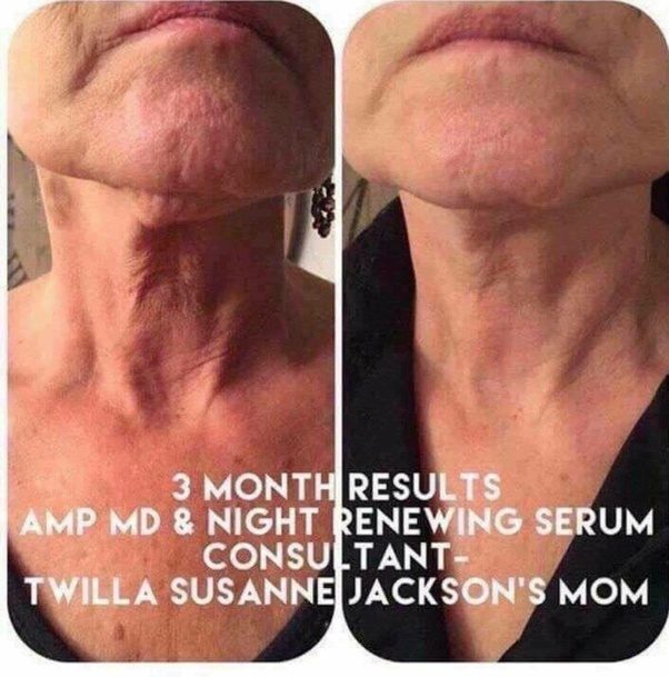 Why does the skin on our neck get loose? Quora