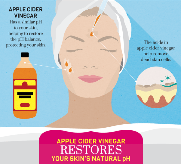 Does apple cider vinegar burn your skin? Quora