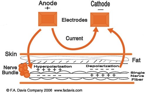Can the charges of a cathode and an anode interchange when the current