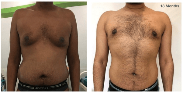 Where can I get surgery done in Bangalore? Quora