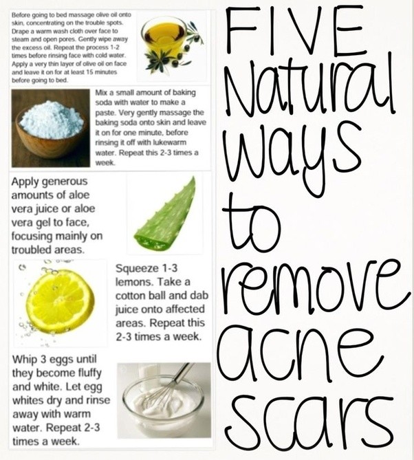 List 104+ Pictures Lemon Juice For Acne Scars Before And After Pictures
