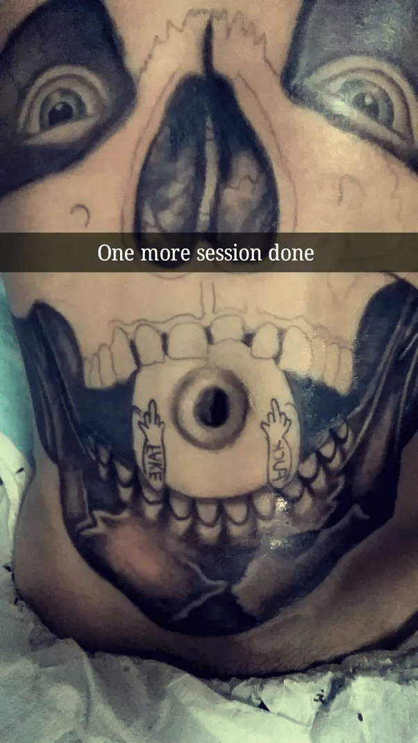 On a scale of 1 to 10 how much does it hurt to get a