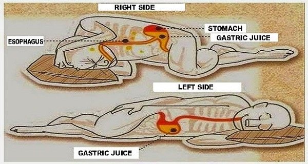 What Side Do You Lay On For An Upset Stomach? - Quora