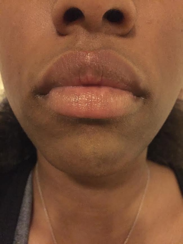 Why is your lips skin a different colour than the rest of