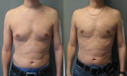 Is Dianabol a good choice for bulking up? Quora