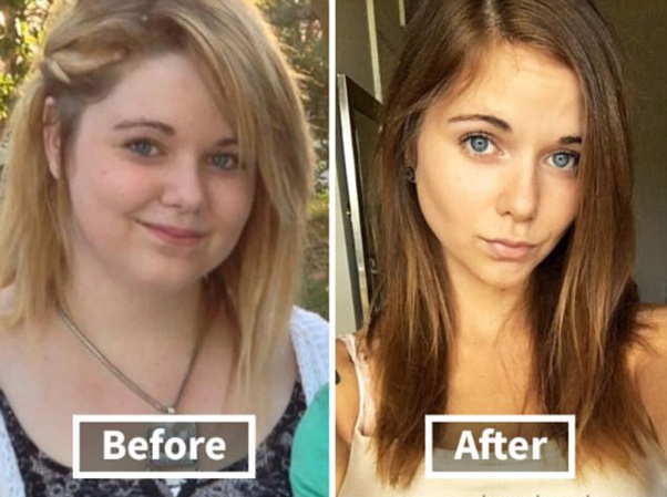 How does someone's face change when they lose weight? Quora