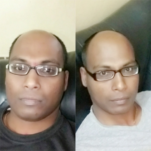 Would my face look more attractive when I lose weight? Quora