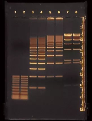 Apa peran etidium bromida dalam elektroforesis gel? - Quora
