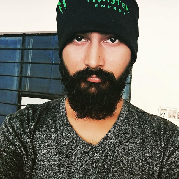 How does it feel going bald or having hair loss at a young