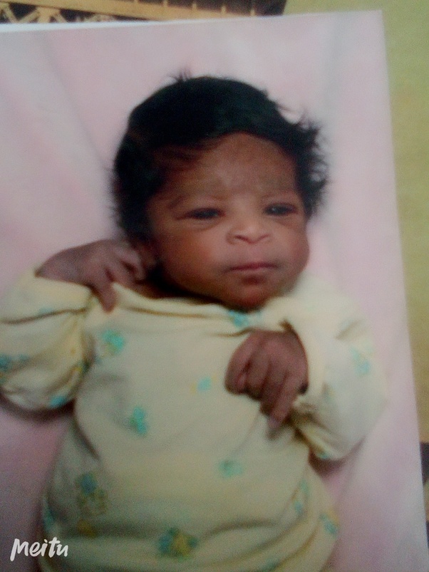 Why does a mixed race (black and white) person have brown skin rather