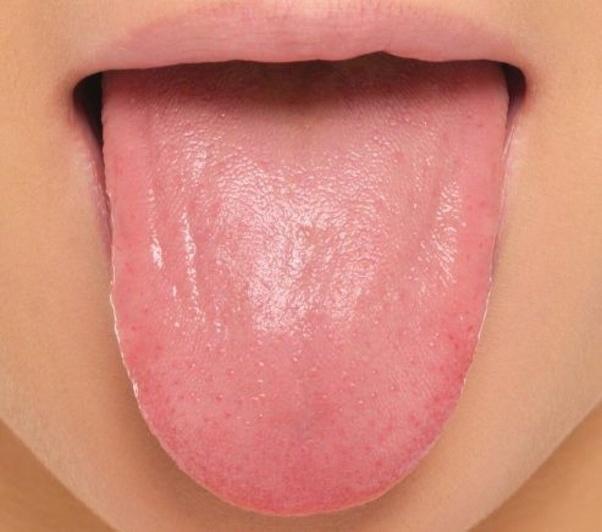 What does a healthy tongue look like? Quora