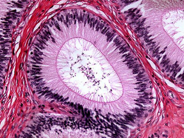 What is the maximum magnification of a compound light microscope? Quora