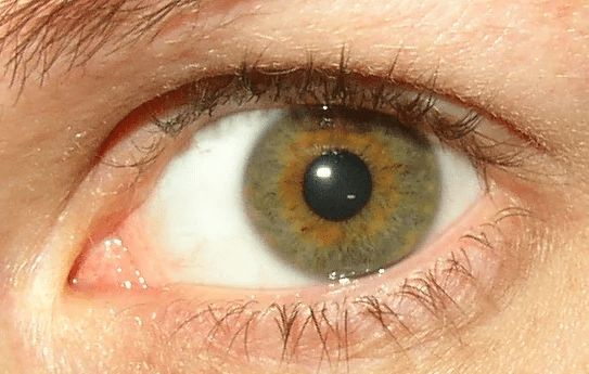 How to know if I have central heterochromia or hazel eyes Quora