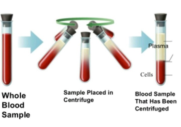 How to separate red blood cells from blood to create water Quora