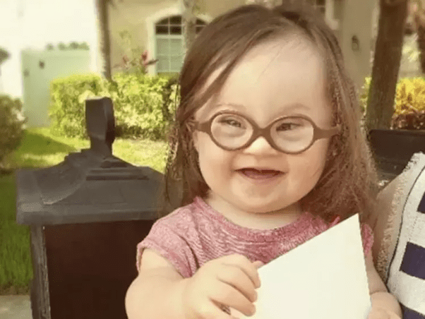 Why does every little girl with Down’s syndrome look exactly the same
