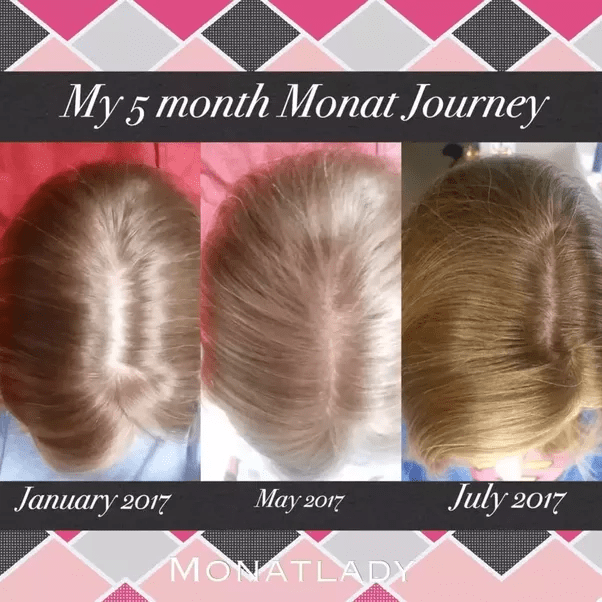 How to reduce hair loss problem and increase hair growth